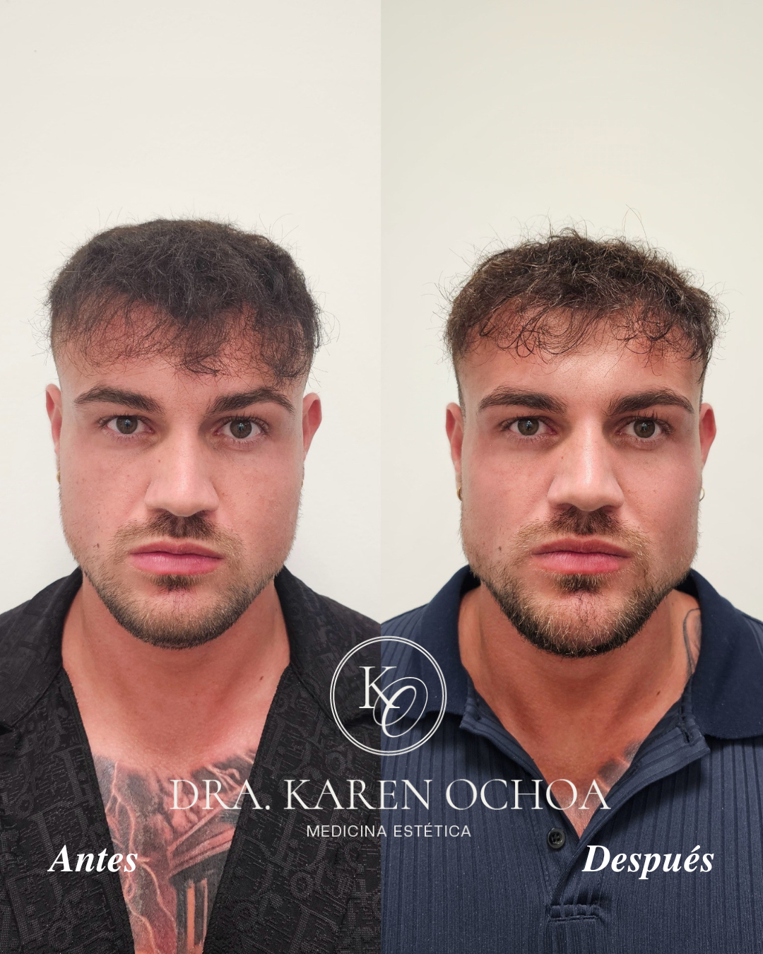 antes y despues Dra Karen