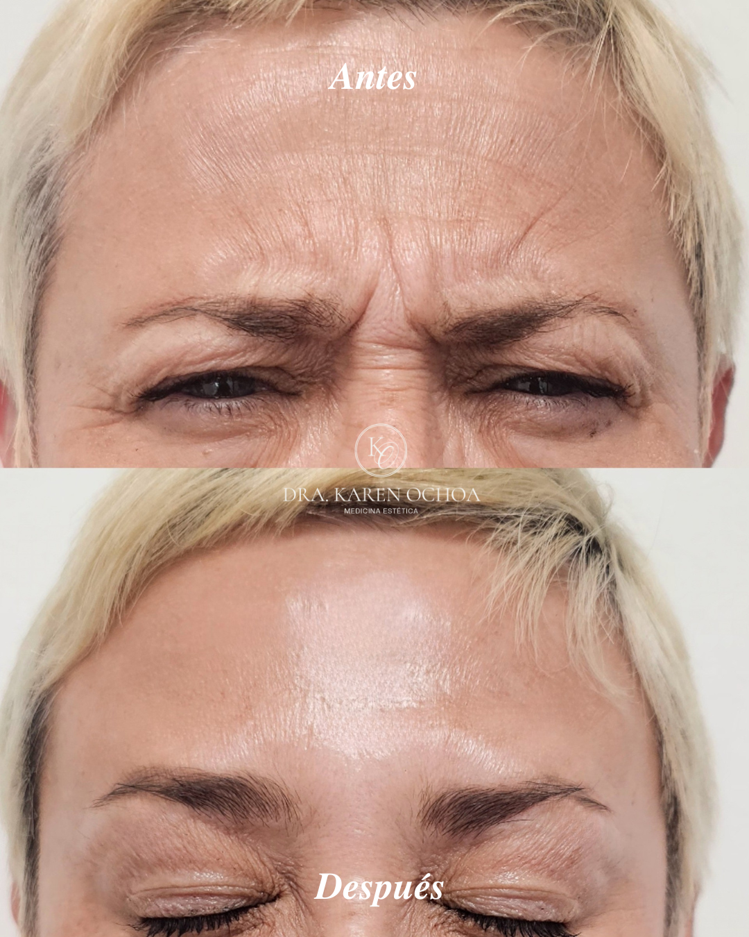 antes y despues Dra Karen (1)