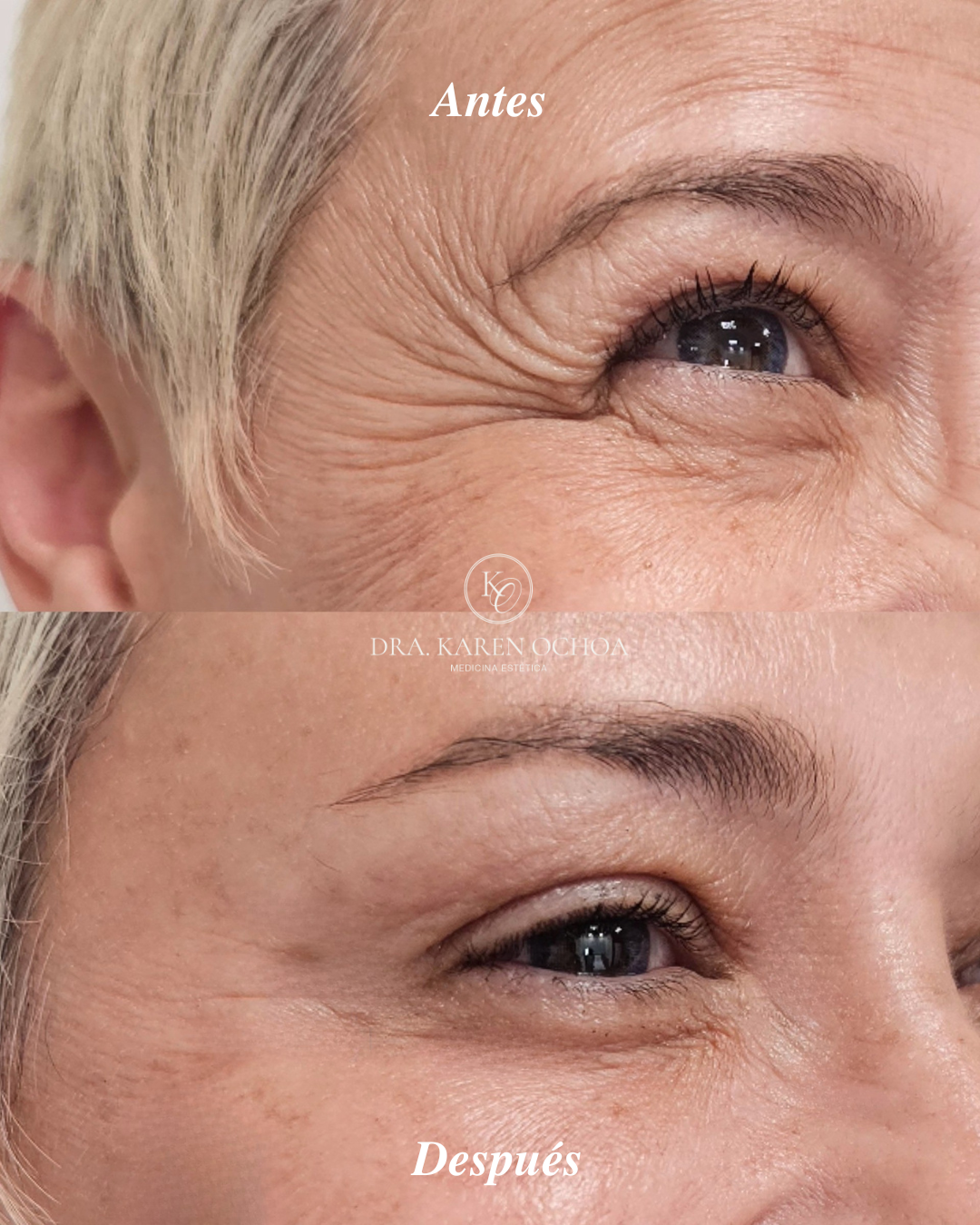 antes y despues Dra Karen (4)